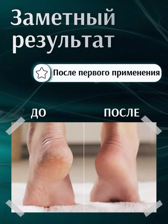 Двухсторонняя терка купить в Интернет-магазине Садовод База - цена 75 руб Садовод интернет-каталог