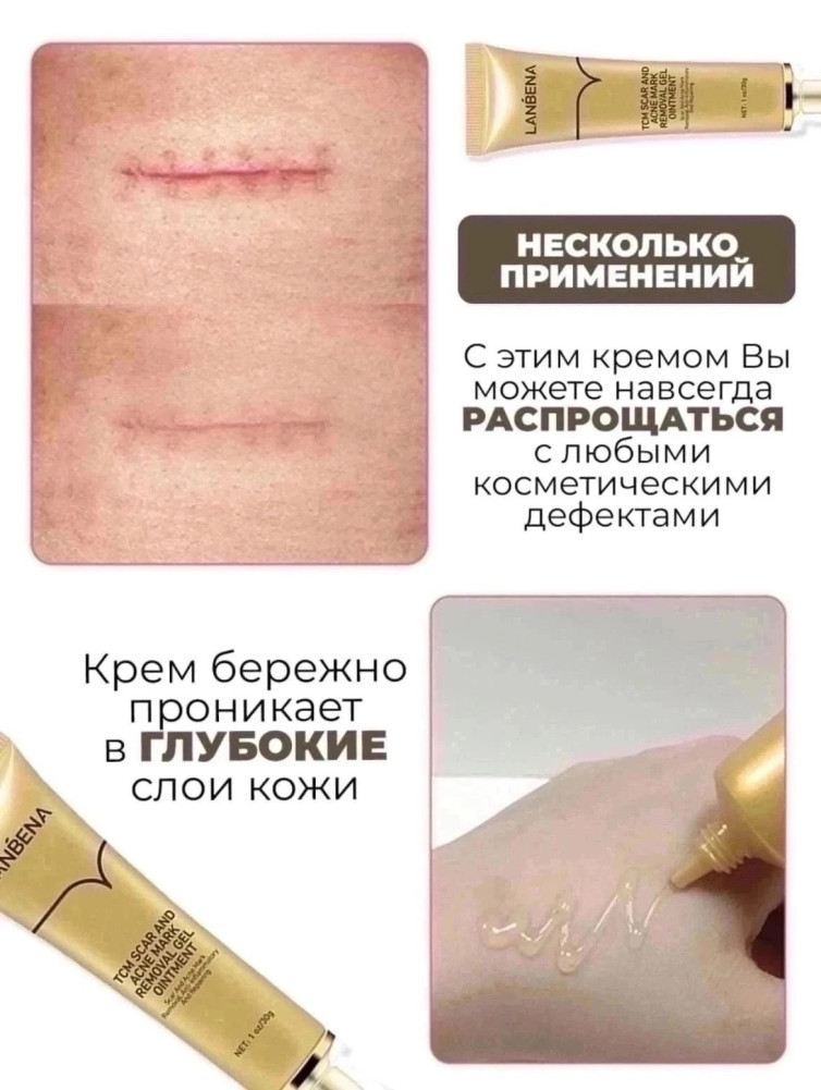 Крем от рубцов и следов от акне купить в Интернет-магазине Садовод База - цена 250 руб Садовод интернет-каталог
