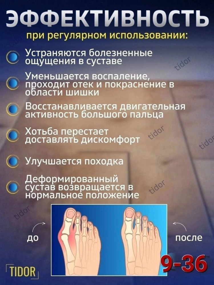 Ортопедический фиксатор для разгрузки плюснефалангового сустава купить в Интернет-магазине Садовод База - цена 100 руб Садовод интернет-каталог
