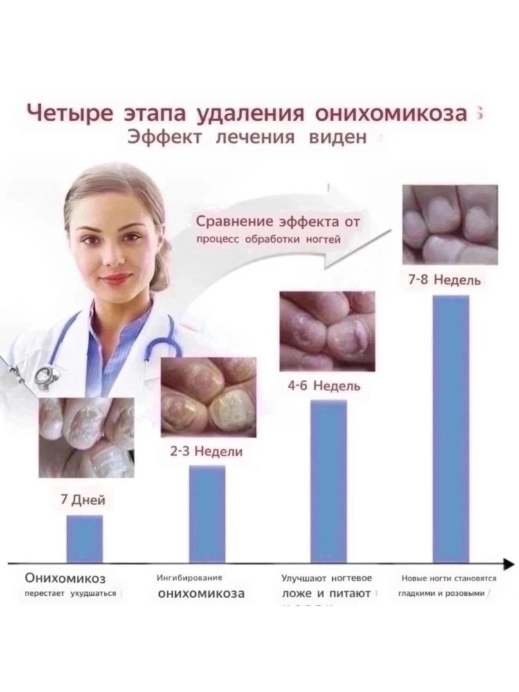 Противогрибковые средства для ногтей купить в Интернет-магазине Садовод База - цена 250 руб Садовод интернет-каталог